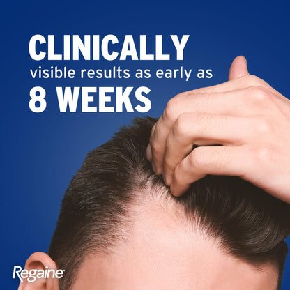 Regaine Men Foam 5% Hair Regrowth Treatment